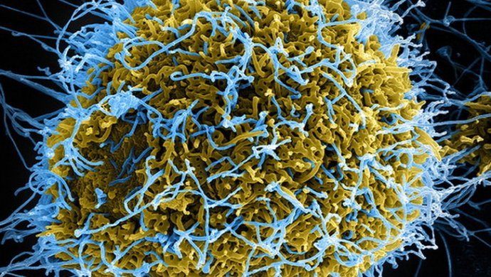 Французские ученые нашли способ победить клетки ВИЧ
