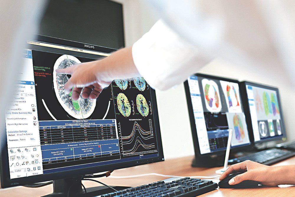 Искусственный интеллект поможет врачам в диагностике