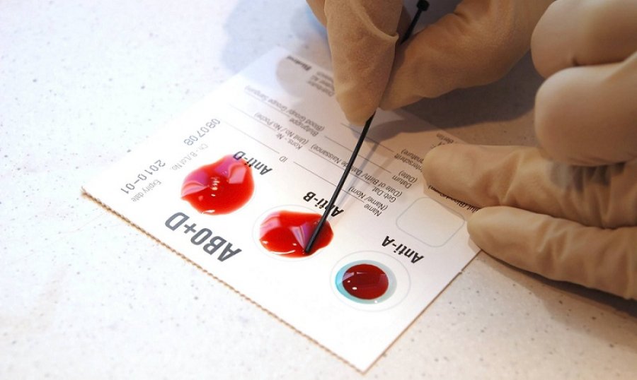 Люди со II группой крови больше подвержены COVID-19