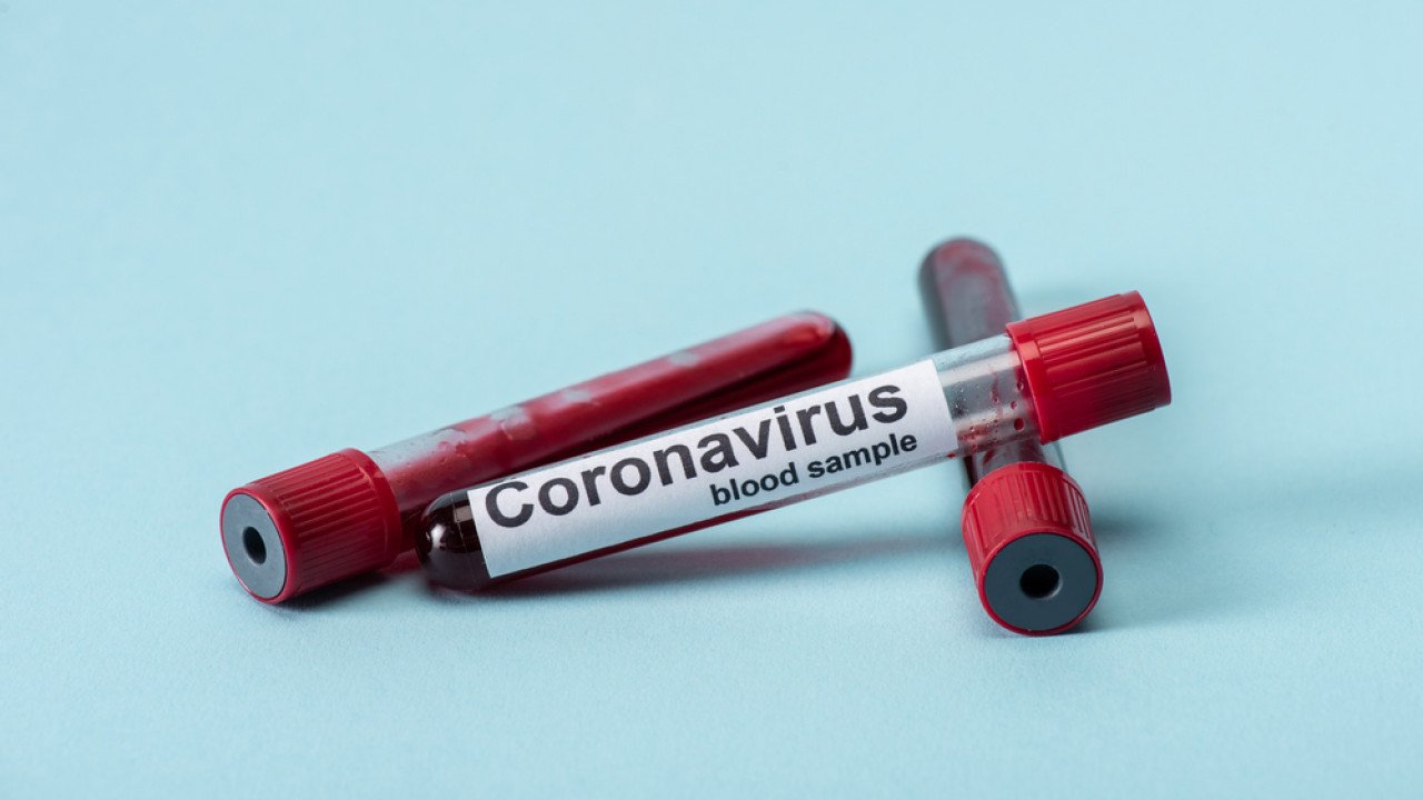 За сутки в Казахстане выявили 1759 больных коронавирусом