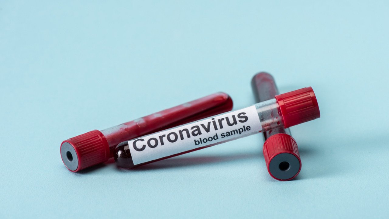За сутки в Казахстане выявили 1499 больных коронавирусом