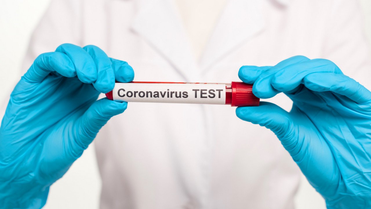 За сутки в Казахстане выявили 1630 больных коронавирусом