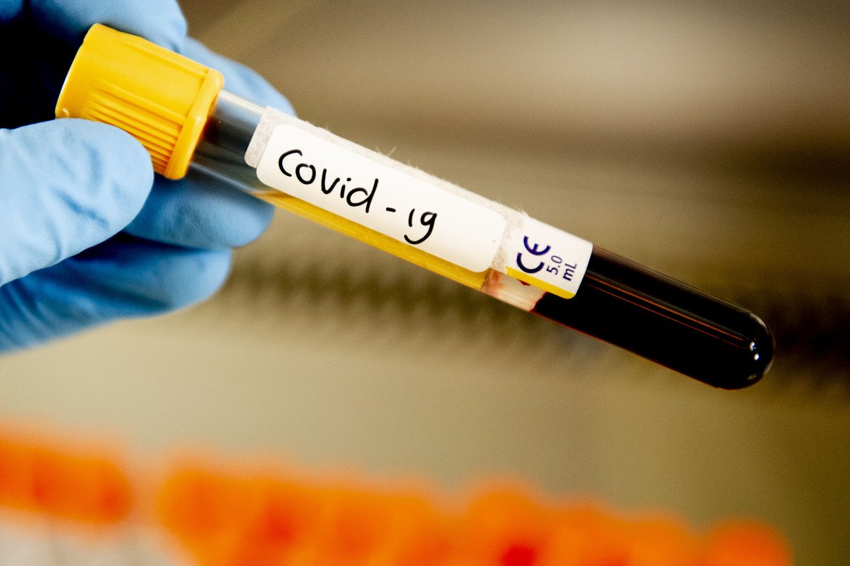 За сутки в Казахстане выявили 1402 больных коронавирусом