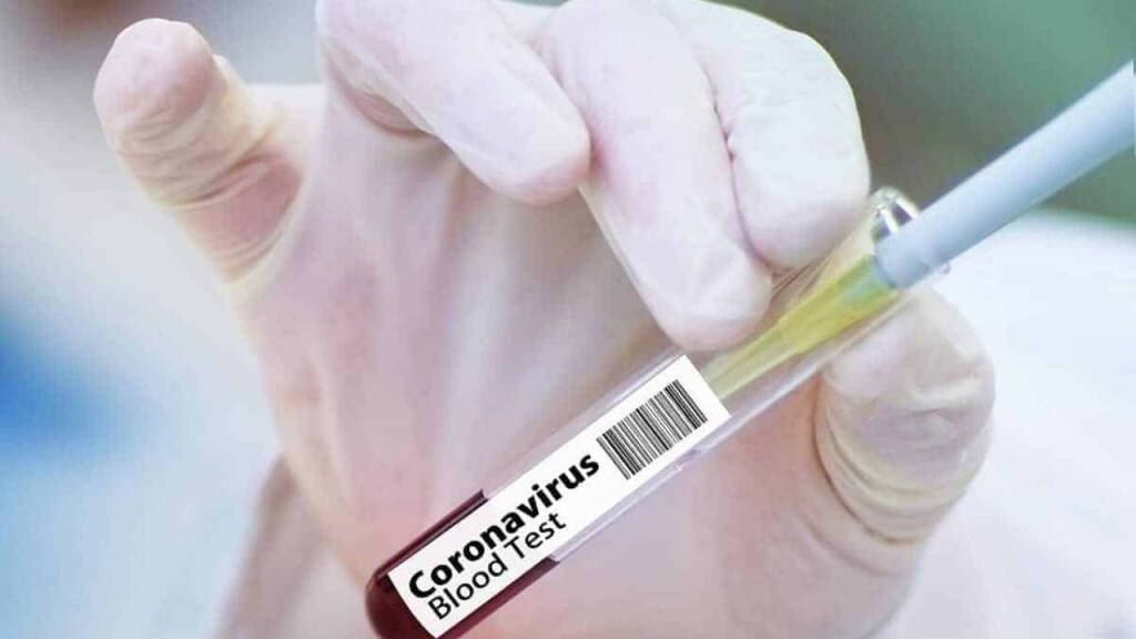 За сутки в Казахстане выявили 78 больных коронавирусом
